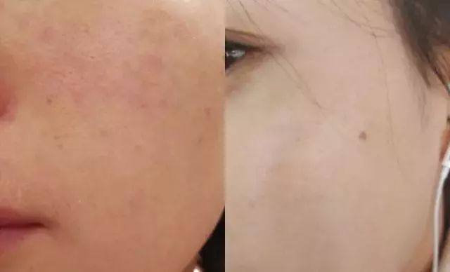 酷皓品牌护肤品,酷皓系列