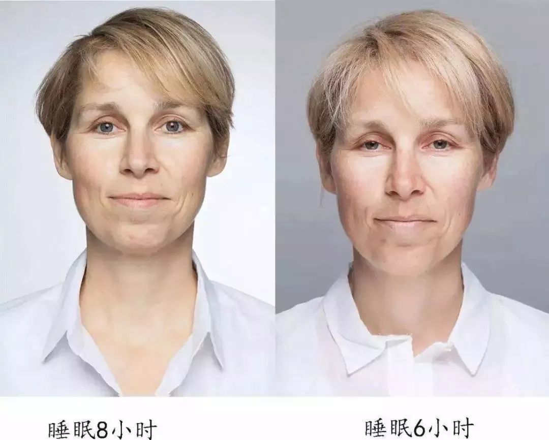 李佳琦推荐淡斑去皱美白,什么样的人最容易长细纹