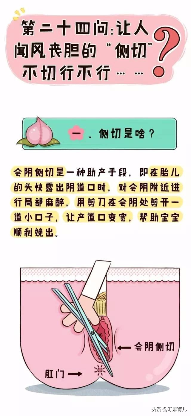 怎么才能防止侧切,怎么才不会被侧切呢