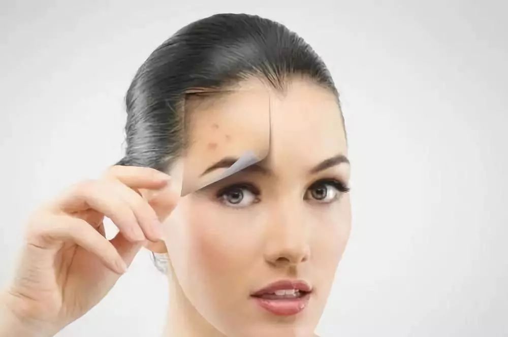 不同人群长斑原因与祛斑方法,长斑的原因你了解吗