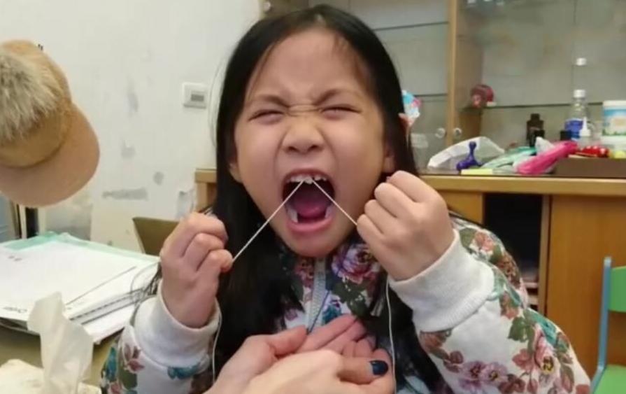 孩子换牙掉的牙怎么处理,孩子换牙掉了怎么处理最好