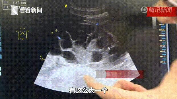 奢饰品降价日用品上涨,奢侈品涨价