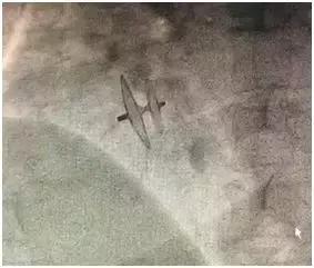 北京天坛医院脑病科,北京天坛医院昏迷病人促醒治疗