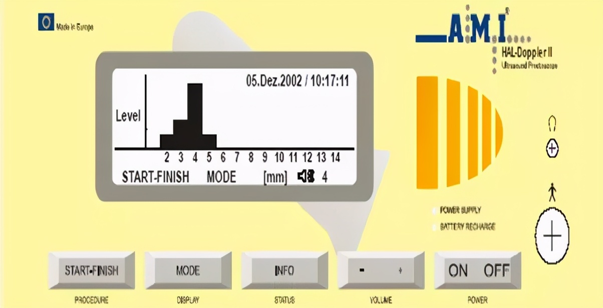 痔疮手术出院后可以不复查吗,痔疮手术后不排便可以出院吗