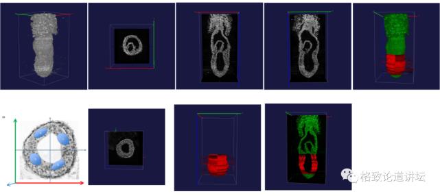 在未来，再生医学能够对我们身体“零件”进行直接的更换？