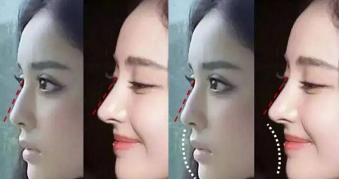 面部一枝花全靠鼻当家,论鼻子对颜值的重要性▼