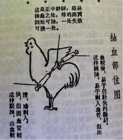鸡血疗法真正无效吗,鸡血疗法的真实案例