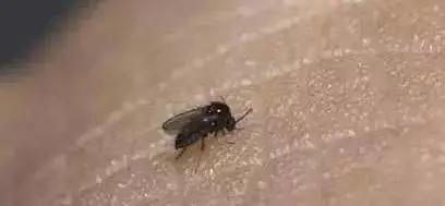 海南小黑虫咬人怎么防御,看到有小黑虫钻进伤口怎么办