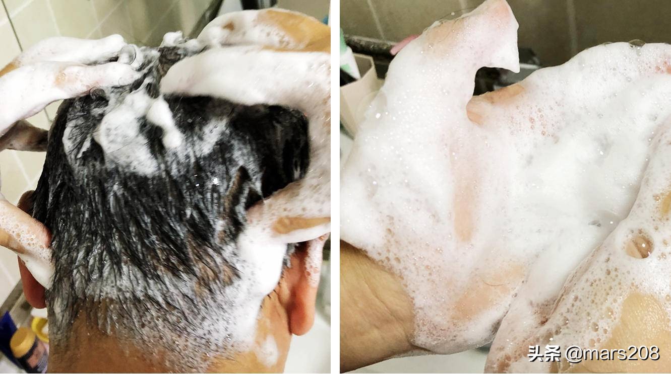 保卫发际线,防脱路上的13款防脱洗护用品使用感受