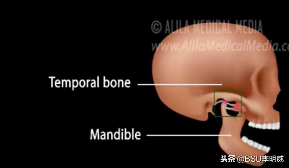 牙咬肌疼的张不开嘴怎么缓解,牙痛咬肌酸痛怎么回事