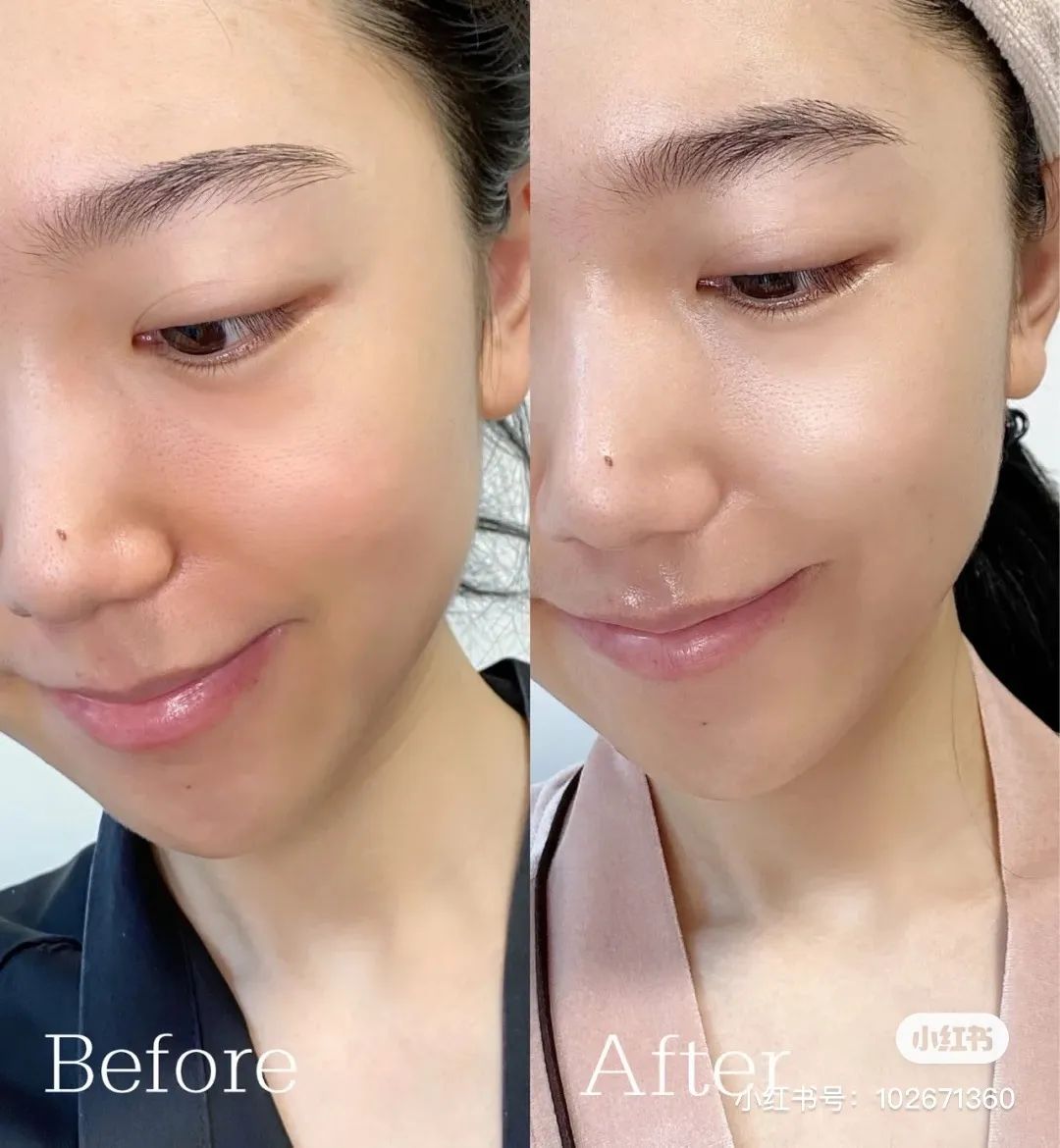 小玛急救水怎么用,小玛急救水好用吗