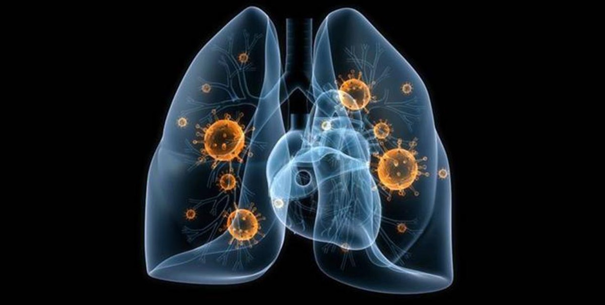 抗艾滋病药物最新突破,抗艾药怎么治疗艾滋的