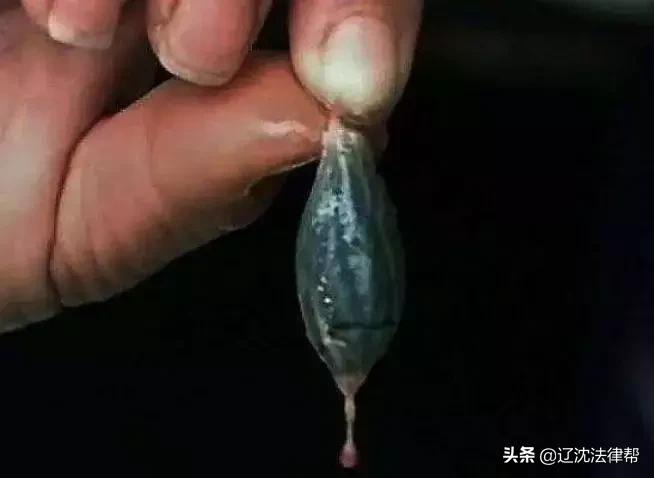 蛇医专家季德胜传奇,旷世神医克林顿