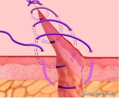 孩子外伤担心感染破伤风?赶紧看这里,实锤搞定家长所有疑问
