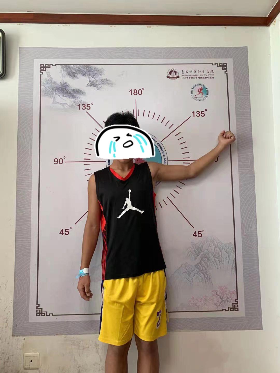 创伤导致肘关节僵硬怎样才能康复,肘关节僵硬康复训练正确方法