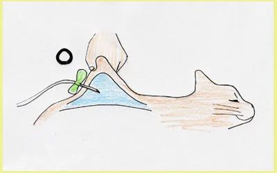 注意这6点让猫咪远离肾脏疾病,猫咪多喝水避免的疾病有哪些