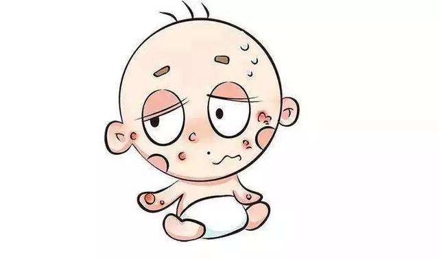 宝宝湿疹怎么处理视频,宝宝总是眼周围长湿疹是什么原因