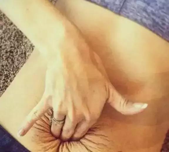 产后肚皮松像口袋一样,产后肚子松垮是腹直肌分离吗