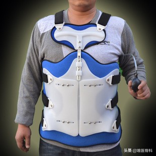 外固定多久恢复,外固定取出一般多久