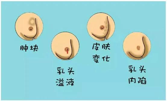 第一次去妇科检查需要注意什么,第一次产检妇科检查都有哪些项目