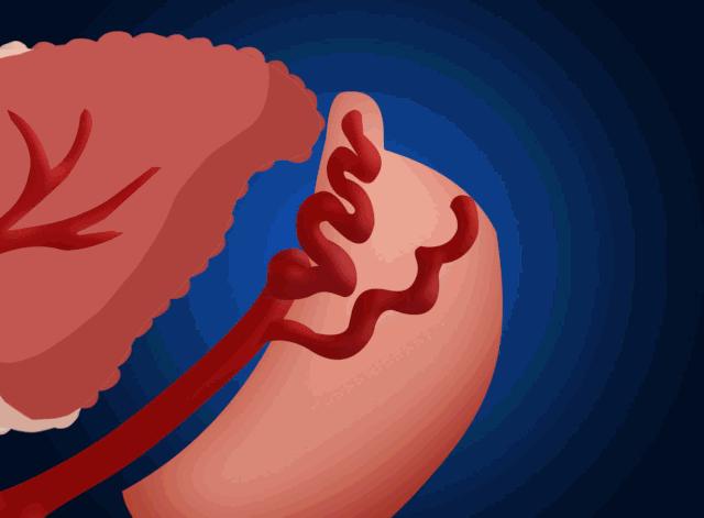 乙肝病人出现吐血便血大概活多久,乙肝吐血止血治疗方法