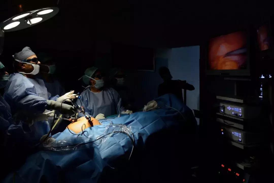 割个阑尾被当堕胎？现代腹腔镜手术先驱的棺材板要压不住了