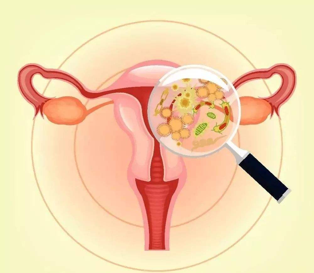 27岁女性便利店买到假避孕套，竟然引发妇科病