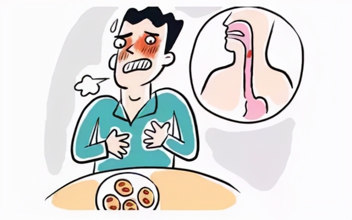 气管呛入异物最佳处理方法,呛住气管异物怎么自救