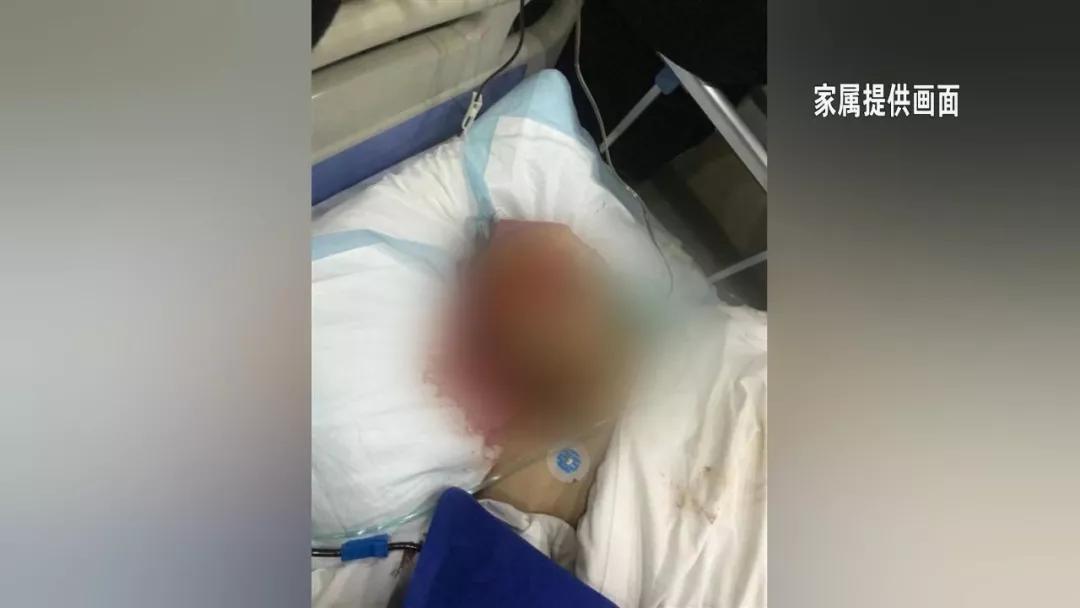 来参加婚宴，被砸伤了……维权找谁？