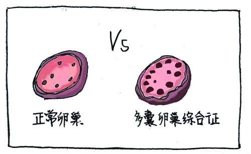 来大姨妈腰痛姨妈量还少怎么回事,女性大姨妈月经量少是怎么回事