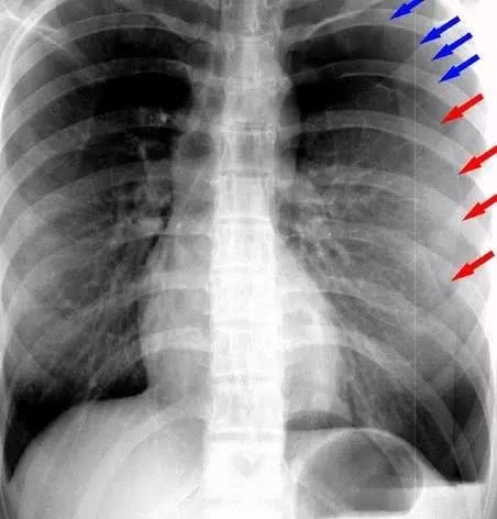 高考体检体重偏胖怎么办,临近高考经常生病