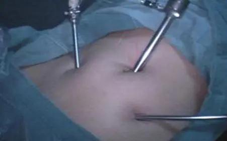 人体诡异未解之谜视频,人类七个未解之谜