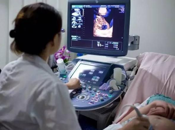 孕六个月四维胎儿做了个鬼脸,四维彩超胎儿做鬼脸