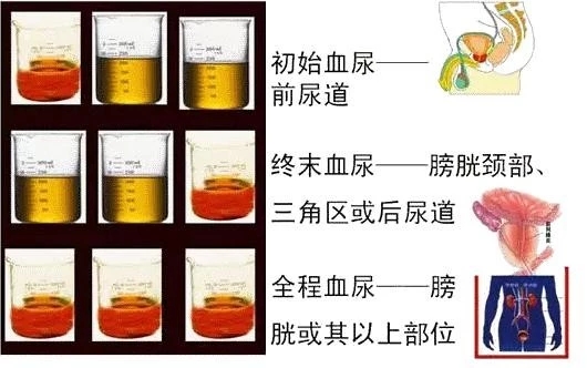 医生查尿是查什么呢,医生尿液化验