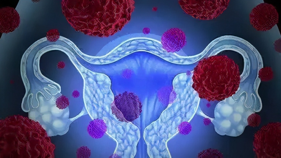 细菌性阴道炎的“克星”,经常吃远离妇科疾病