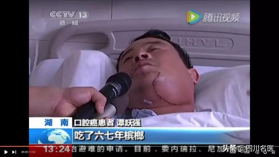 口腔溃疡喝酒变成口腔癌,口腔溃疡频繁发作是不是口腔癌