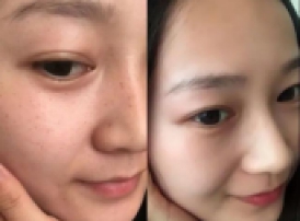 名寿堂祛斑套多少钱,名寿堂的祛斑产品是真的假的