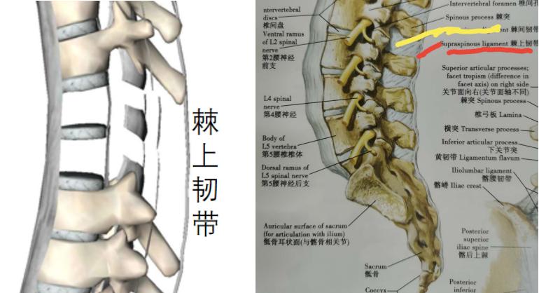 急性腰扭伤的正确睡姿,急性腰扭伤按哪个穴位图解
