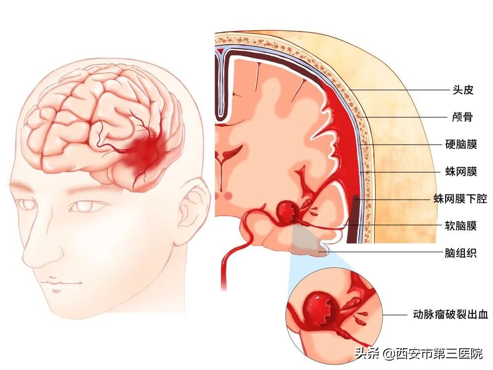专治二便不畅的偏方,经颅磁能治疗大小便失禁吗