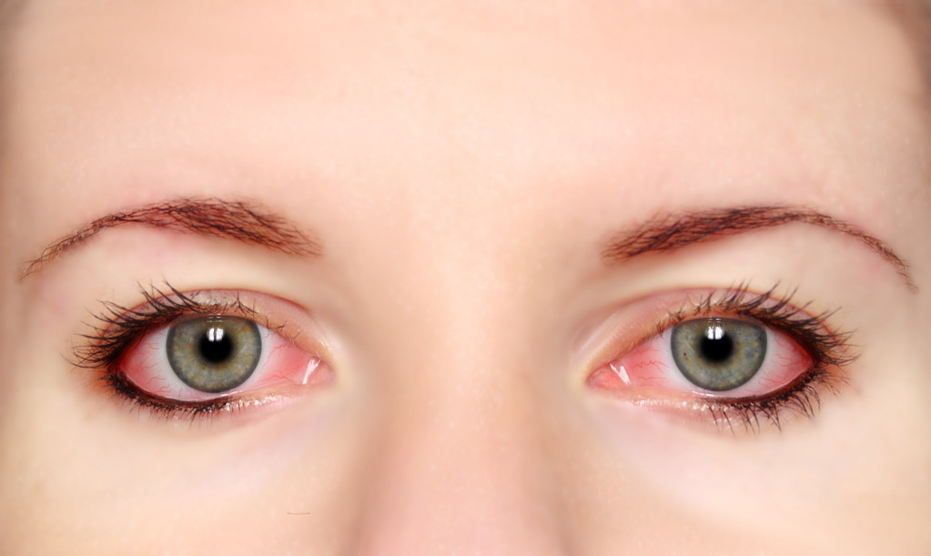 一到这个季节眼睛就发痒怎么治呢,眼睛一到春秋季节就奇痒无比