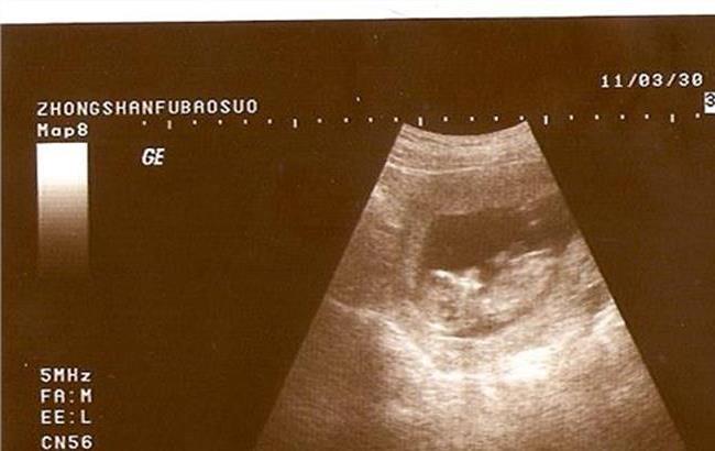 月经排毒对皮肤更好吗,月经排的是啥