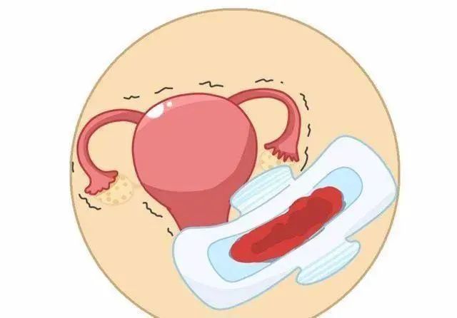 排卵期出血有可能是宫颈癌么,排卵期出血可能会是宫外孕吗