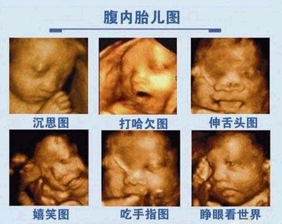 孕期准妈妈需要做什么检查,孕期妈妈心脏彩超多少周做