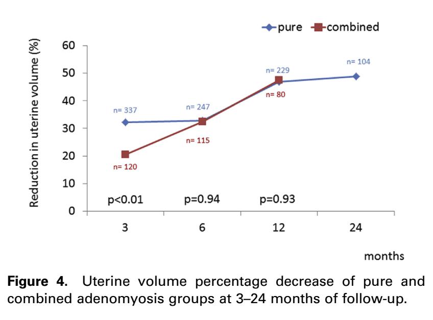 从手上扎针插管就能治子宫腺肌症——经桡动脉入路子宫动脉栓塞术