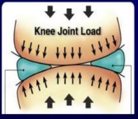 半月板损伤最简单自己鉴别方法,健康之路半月板损伤怎样治疗
