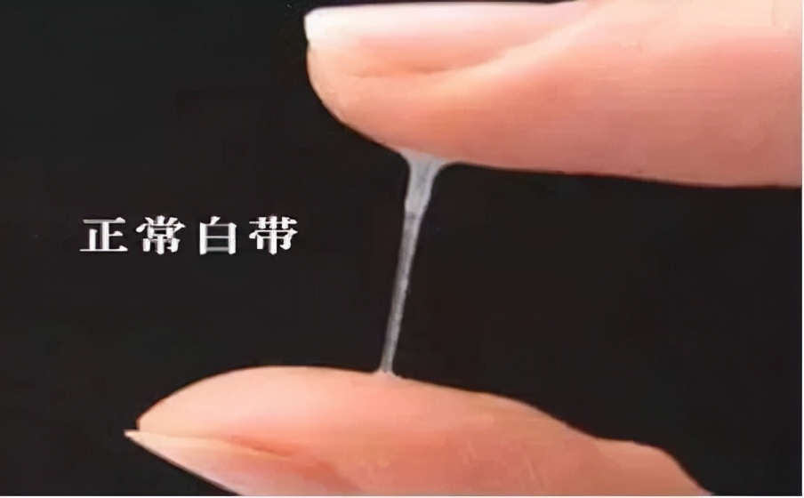 内裤老是有黄的分泌物怎么回事,内裤分泌物为什么是黄的
