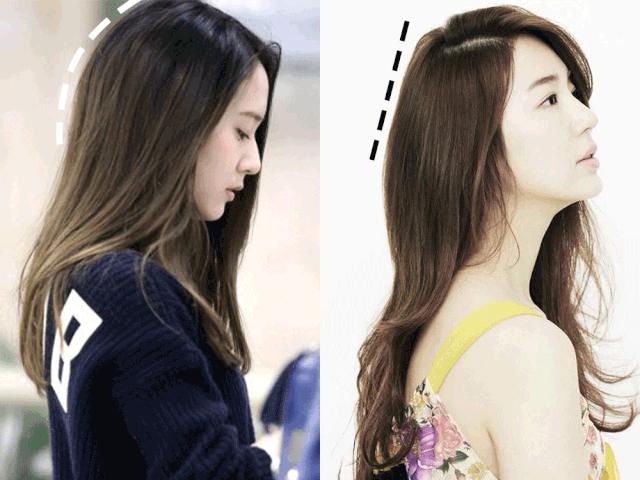 天生头扁怎么矫正,天生头扁在医学上怎么弄