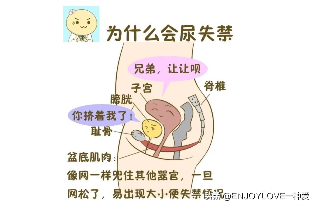 产后漏尿,都是盆底肌损伤惹的祸