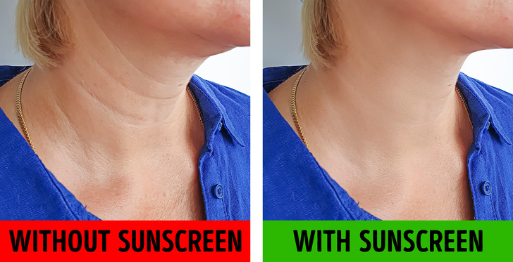 减少面部赘肉,减少面部双颊脂肪的医美项目