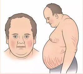 小伙腿上银屑病,男大学生截肢事件